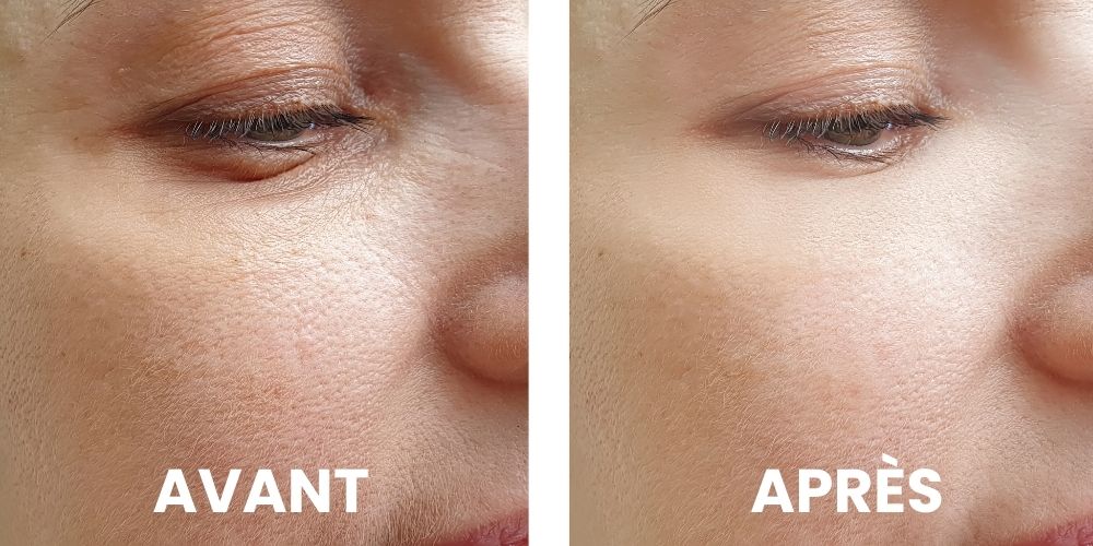 Avant-après routine ENAYA pour peau sèche en hiver